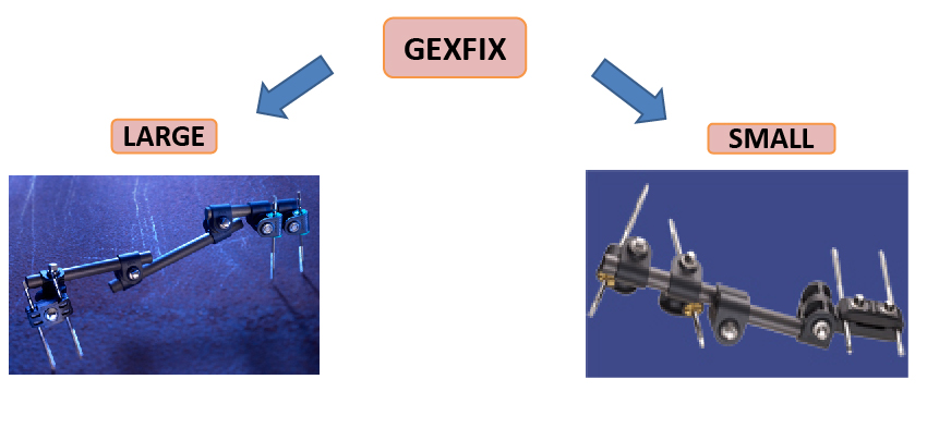 gexfix 13